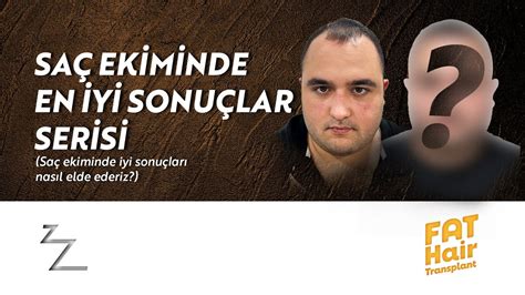 SAÇ EKİMİ ÖNCESİ SONRASI FAT SAÇ EKİMİ İLE GÜÇLÜ SONUÇ YouTube