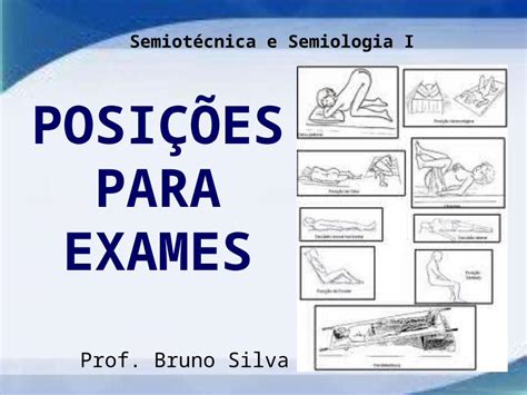 Ppt Posi Es Para Exames Prof Bruno Silva Semiot Cnica E Semiologia