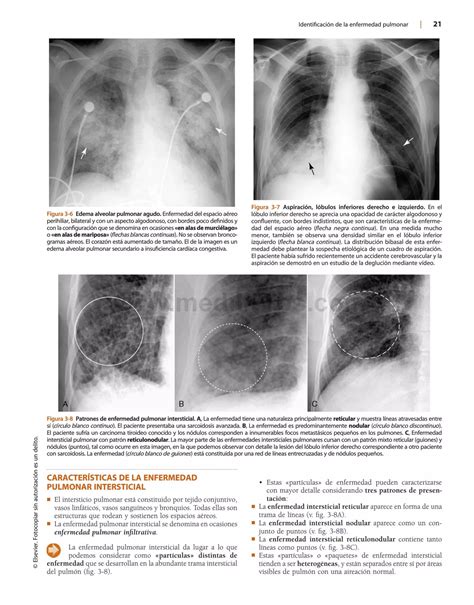 Herring Radiologia Basica Aspectos Fundamentales Pdf