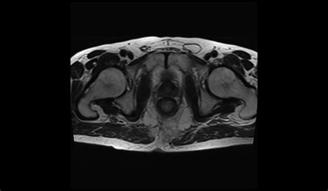 Deep Resolve MRI AI MRI Reconstruction