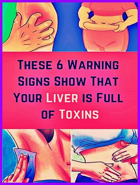 6 Warning Signs That Indicate Your Liver Is Full Of Toxins Artofit