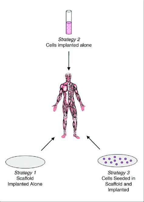 Three Main Approaches To Tissue Engineering Strategy 1 To Guide Download Scientific Diagram