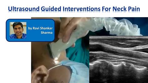 Ultrasound Guided Interventions For Neck Pain Headache Youtube