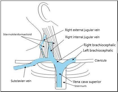 1 Anatomy Of Internal Jugular IJV And Subclavian Veins SV