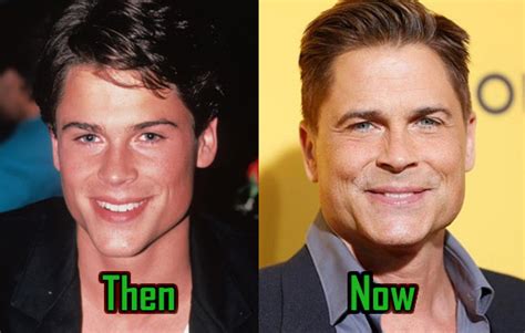 Rob Lowe Plastic Surgery Of Facelift Fillers Before And After