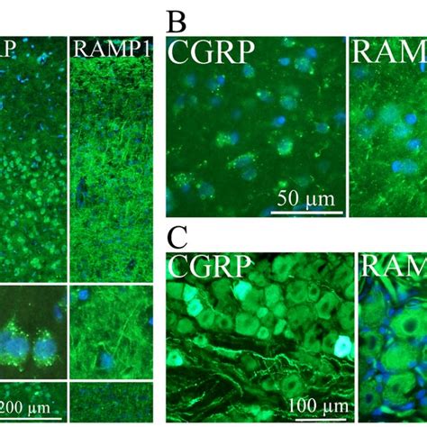 Calcitonin Gene Related Peptide Cgrp And The Cgrp Receptor Component