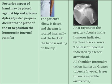 Chapter 6 Positioning Essential Projections Shoulder Proximal