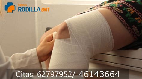 Luxación de rodilla Cirugía y tratamiento convencional para su