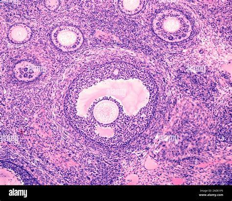 Low Magnification Light Micrograph Showing Several Secondary Ovary