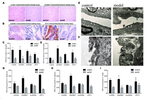 Impact Of Psychological Stress Stimulation On Tight Junction Proteins