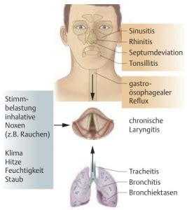 chronische Laryngitis Kehlkopfentzündung Praxis für HNO Phoniatrie