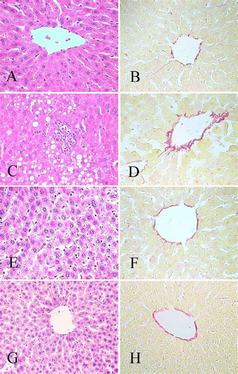 Liver Histology Of Rats H And E Staining Of The Liver Sections Of A