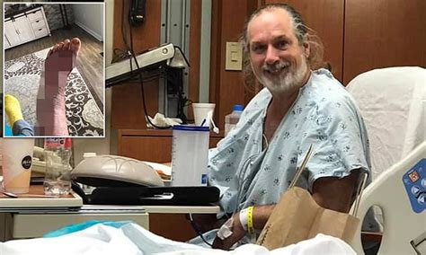 Tourist Nearly Loses His Foot After Catching Flesh Eating Bacteria In