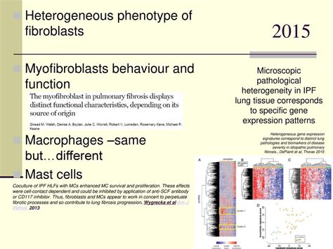 Pathology Of The Idiopathic Pulmonary Fibrosis Facts And Controversies Ppt Download