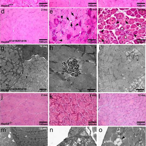 Hspb8 Aggregates And Low Autophagy Power In The Sciatic Nerve Of