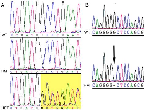 Figure From Biallelic Mutation Of Protocadherin Pcdh Causes