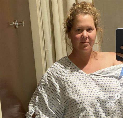 Amy Schumer Has Uterus And Appendix Removed Due To Her Endometriosis