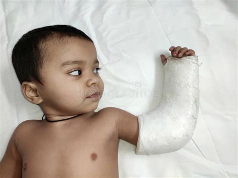 Young Boy Fractured Hand Plaster Cast Stock Photos Free And Royalty