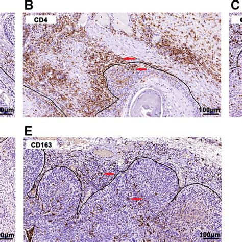 Microphotographs Of Representative Examples Of The Five Immune Markers