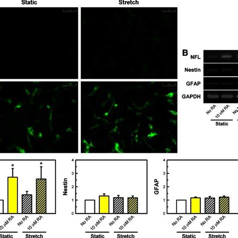 Microtubule Associated Protein 2 Map2 Immunofluorescence And