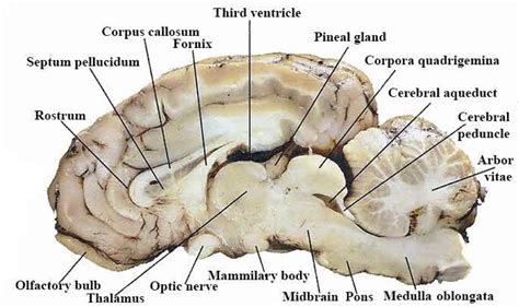 Sheep Brain Anatomy Sagittal View Diagram Quizlet Hot Sex Picture