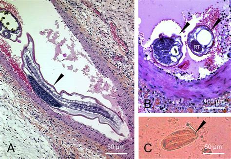 Microscopical Aspects Of The Ileal Specimen And Parasitic Stools Download Scientific Diagram