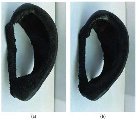 A Previous Design Of Artificial Ear Splint B Current Design