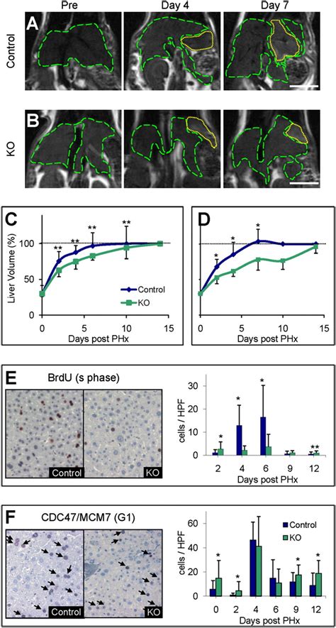 Accelerated Carcinogenesis Following Liver Regeneration Is Associated