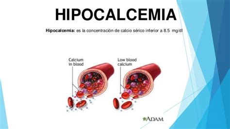 Hipercalcemia E Hipocalcemia