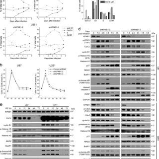 KPNB1 Deficiency Induces Apoptosis In Glioblastoma Cells A U87 And