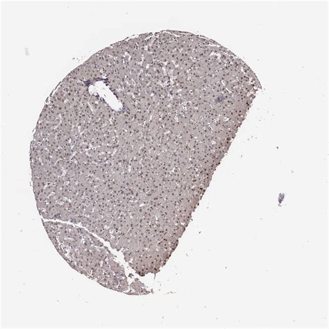 Tissue Expression Of Ppara Staining In Liver The Human Protein Atlas