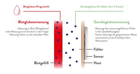 Warum Sensorbasierte Kontinuierliche Glukosemessung Fachpersonal