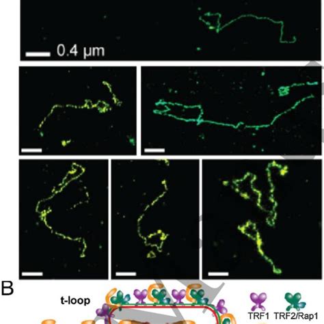 SMLM Enables Imaging Of In Vivo Nanoscale Chromatin Structure A STORM