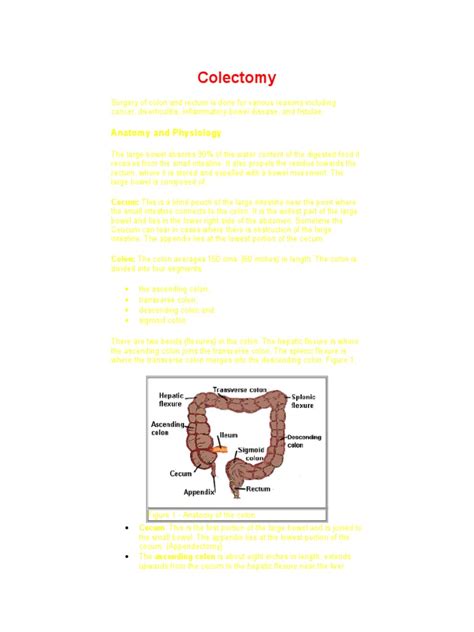 Colectomy | Colorectal Cancer | Colonoscopy