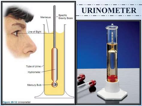 Physical And Chemical Examination Of Urine PPT