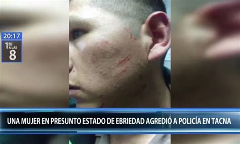 Policía terminó con heridas en el rostro tras agresión de mujer Canal N