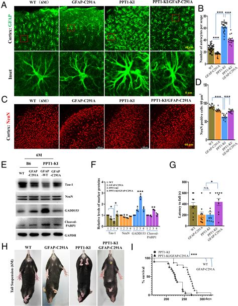 GFAP Hyperpalmitoylation Exacerbates Astrogliosis And Neurodegenerative