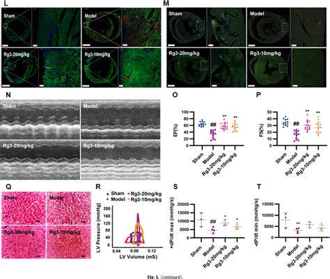 Figure 1 From Ginsenoside Rg3 Ameliorates Myocardial Glucose Metabolism