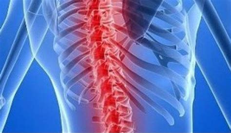 Tratamiento De Lesiones Medulares