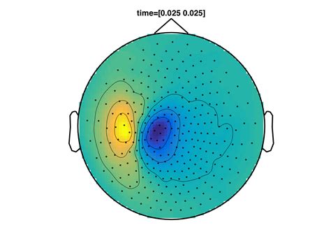 Preprocessing Of Eeg And Meg Data Fieldtrip Toolbox