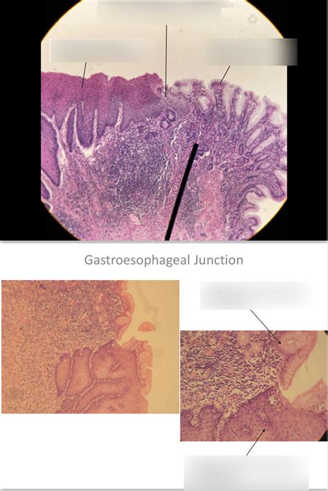 Gastroesophageal Junction And 40x Diagram Quizlet