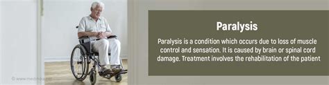 Paralysis Types Causes Symptoms Diagnosis Treatment And Prevention