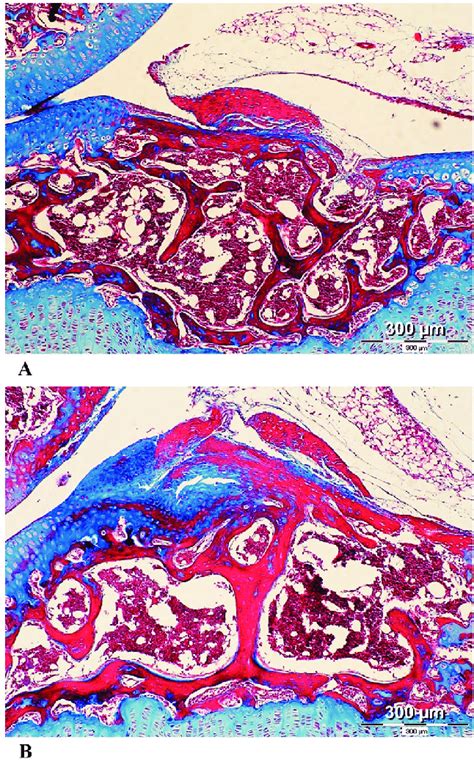 Histological Sections Of Mouse Tibial Epiphyses Masson S Trichrome