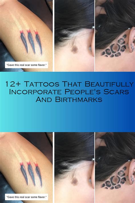 12 Tattoos That Beautifully Incorporate People S Scars And Birthmarks