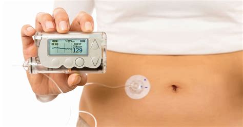 Diabetes Mellitus Type Pump