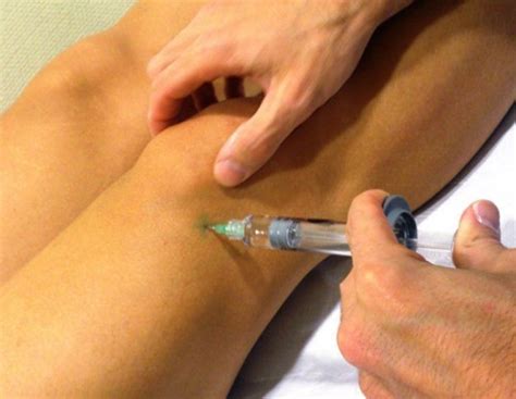 Injection Acide Hyaluronique Tunisie Traitement Pour L Arthrose