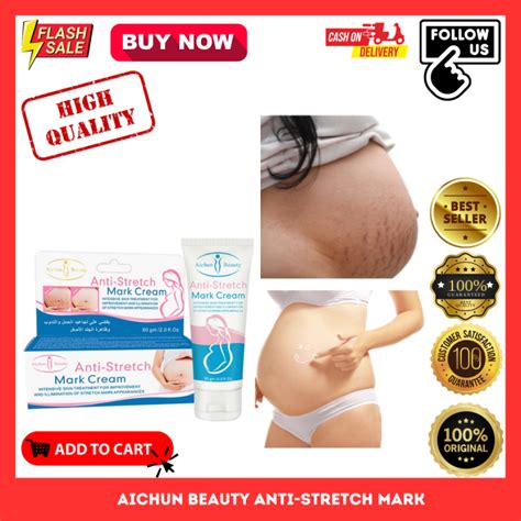 Aichun Authentic Anti Stretch Mark Cream Dark Spot Remover For Pregnant