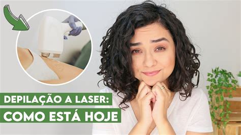 DEPILAÇÃO A LASER RESULTADO 3 ANOS DEPOIS Morena Raiz YouTube