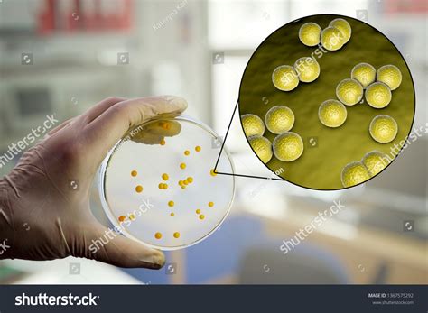 Colonies Micrococcus Luteus Bacteria On Agar 库存插图 1367575292 Shutterstock