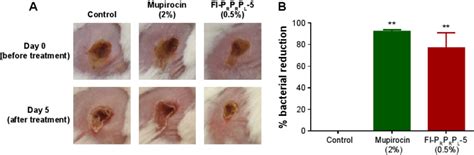 Mrsa Treatment